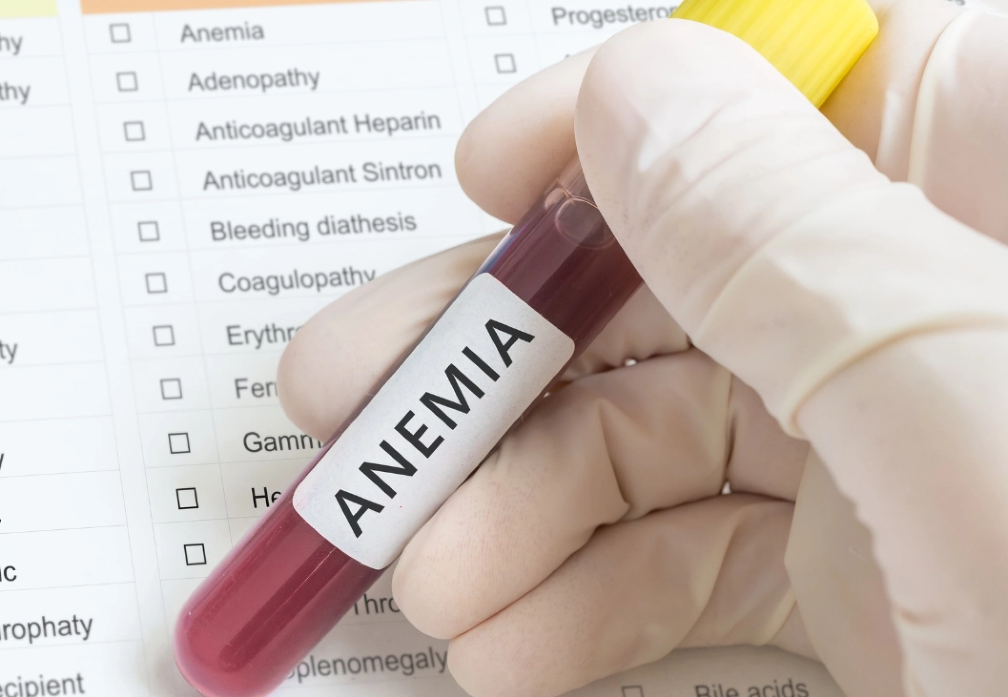 Anemia-Codes-CPT